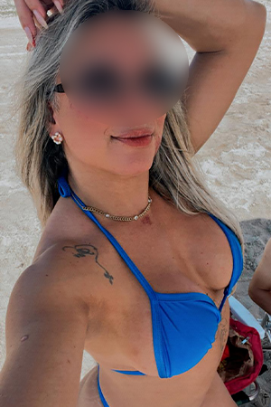 Foto do anúncio acompanhante ANA